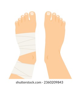 compression bandage wrapped around the twisted ankle- vector illustration