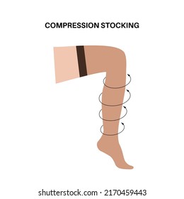 Compression stocking concept. Pressure problems with varicose veins. Special fitness socks for insufficiency venous. Surgery rehabilitation clothes. Healthy slender female feet vector illustration.