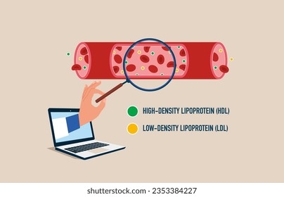 Computer cardiologist studying blood vessels and veins. Heart disease research. Flat vector illustration