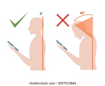 Computer neck syndrome, tech neck, text neck. Correct and incorrect head position when working with a mobile phone. Flat vector illustration. Male silhouette isolated on white background