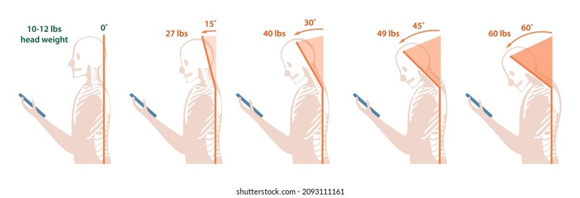 Computer neck syndrome, text neck, tech neck. Changes in pressure on the cervical spine with different head positions. Flat vector illustration. It is isolated on white background