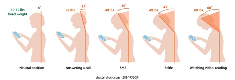 Computer neck syndrome, text neck, tech neck. Changes in pressure on the cervical spine with different head positions. Flat vector illustration. Woman is isolated on white background