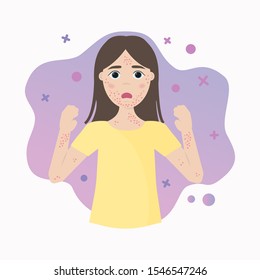 The concept of allergy. Skin problems, rashes, acne, pimples. Vector illustration.