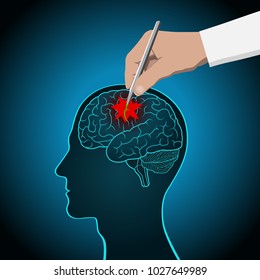 The concept of brain recovery, memory, stroke, treatment of brain diseases