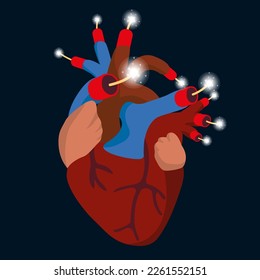Concepto del peligro de fumar con un corazón cuyas arterias están bloqueadas simbólicamente por palos de dinamita.