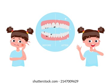 The concept of dental caries treatment. Crying girl with pain before treatment and happy after treatment. Under magnifying glass tooth with caries and healthy tooth. Vector illustration