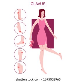 Concept of foot callus. Pain markers on foot. Woman having a painful skin damage, trauma. Vector illustration of body injury.