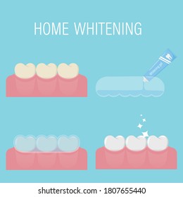 The Concept Of Home Teeth Whitening From Yellow To White. Consecutive Stages Of Bleaching With Gel And Mouthguard At Home.Before And After. Modern Comatic Procedure. Isolated Vector Illustration. Flat