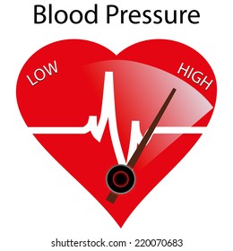 Concept Of Hypertension, Vector Illustration