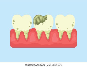 concept illustration of cavities on a blue background, flat style vector illustration.