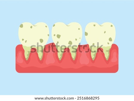 concept illustration of yellow teeth, dirty teeth, flat style vector illustration.