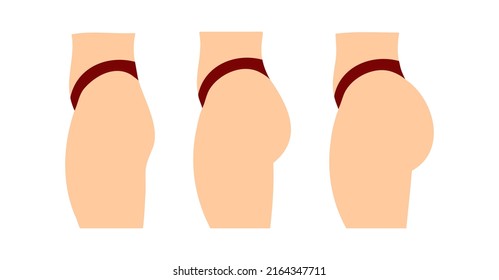 Concept of an increase in the buttocks. Vector concept illustration isolated on white background, side view profile. Flat women butt set in bikini.