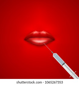 Concept of injections in lips for beauty. Red Lips and syringes. Vector illustration.