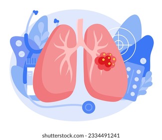 The concept of lung cancer. A malignant tumor develops in the lungs. The structure of a cancer cell. Flat vector illustration
