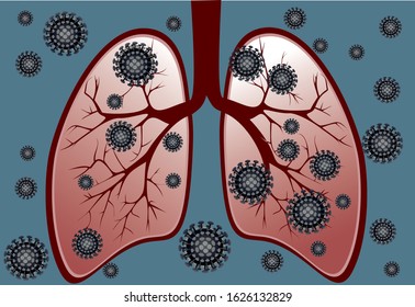 Concept of new 2019 coronavirus in China. Middle East respiratory syndrome coronavirus attacks human lungs