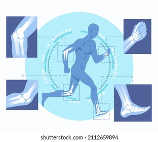 Concept of orthopedic technology. Running man with X ray interface. Treatment of broken bones and damaged ligaments. Innovations in medical examination. Cartoon modern flat vector illustration