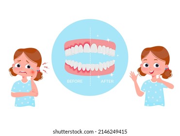 The concept of periodontitis treatment.  Periodontitis illustration. Crying girl with pain before treatment and happy after treatment. Under magnifying glass, diseased gums and healthy gums. Vector