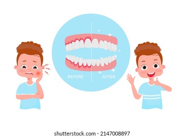 The concept of periodontitis treatment.  Periodontitis illustration. Crying boy with pain before treatment and happy after treatment. Under magnifying glass, diseased gums and healthy gums. Vector