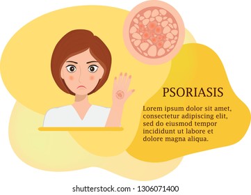 Concept of psoriasis, vector poster with fluid background. Sad cute girl. Disease of the skin and dermatological problems. 