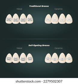 The concept of teeth alignment with braces. Orthodontic dentistry. The alignment of the teeth. Beautiful white teeth. Isolated flat vector illustration. Simple teeth in a row. Orthodontic treatment.