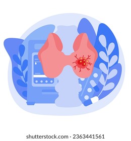 The concept of thyroid cancer. Endocrinologists diagnose and treat a person's thyroid gland. Vector illustration