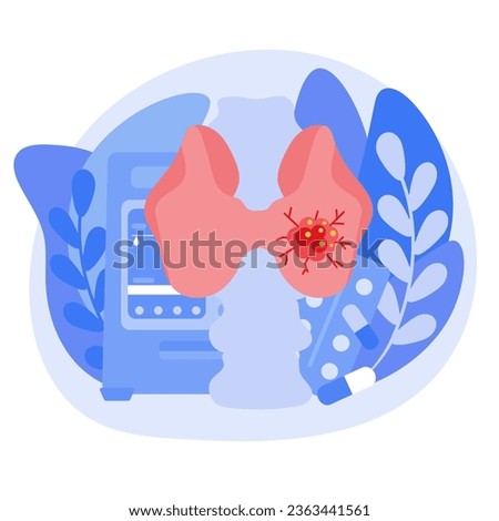 The concept of thyroid cancer. Endocrinologists diagnose and treat a person's thyroid gland. Vector illustration