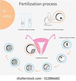 Conception and in vitro fertilization. Infographics process. Icons. Stages of formation of the embryo