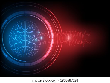 Concepts Of Focal Seizure. Illustration Of Human Epileptic Brain And Abnormal Electroencephalography Or EEG Wave Discharges