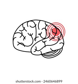 concussion brain or head ache thin line icon. linear trend modern simple logotype graphic lineart design isolated on white background. concept of