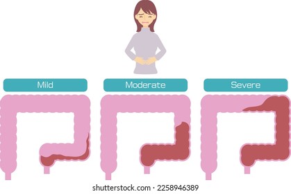 Condition of constipation from mild to severe