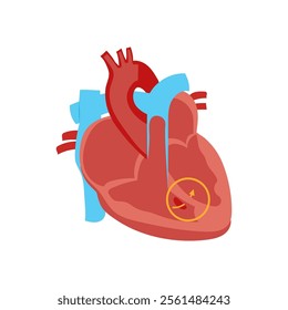 Congenital Heart Defect, Cardiovascular Disease Illustration Icon