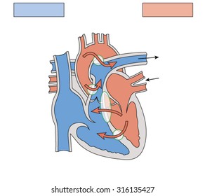 Congenital heart defects resulting in abnormal blood flow through the heart and to the lungs, resulting in Eisenmengers syndrome.