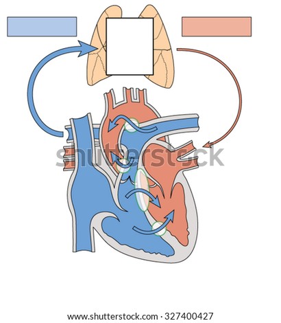 Congenital heart defects resulting in abnormal blood flow through the heart and to the lungs, resulting in Eisenmengers syndrome.