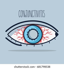 conjunctivitis allergic inflammation of vision eye