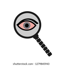 Conjunctivitis concept with red eye and lacrimation - symptom of swelling of conjunctiva or allergy in flat vector illustration. 