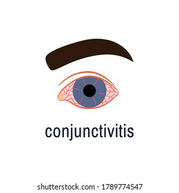 Konjunktivitis Symbol einzeln auf weißem Hintergrund. Wasseriges rotes Auge-Logo. Symptom einer Virusinfektion während der Saison allergische Augenkrankheit Virusentzündung. Farbflachstil Ophthalmologie, medizinische Vektorgrafik
