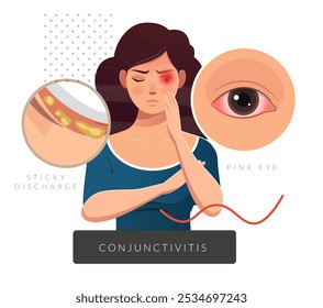 Conjunctivitis - Pink eye and Excessive Sticky Discharge from Human Eye - Stock Illustration  as EPS 10 File