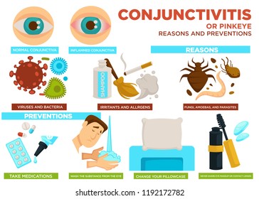 Conjunctivitis or pinkeye reasons and preventions poster vector