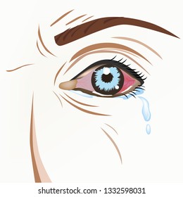 Conjunctivitis (Pinkeye) :The conjunctiva is the thin clear tissue that lies over the white part of the eye and lines the inside of the eyelid.