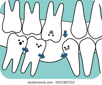 
consequence of not fixing the denture after tooth loss - flat illustration 