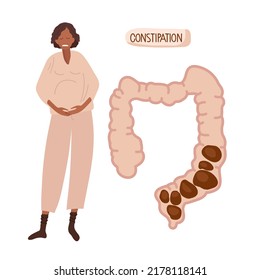 Constipation during pregnancy. Pregnant woman holding her belly. Human large intestine with fecal matter. African American Woman suffers from constipation, feel bad. Flat vector illustration