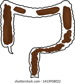 Constipation. Feces in colon. Infographics. Vector illustration on isolated background.