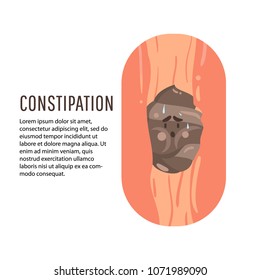 Constipation Symptom In A Man And Poop In Intestine.