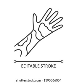 Dermatitis de contacto, urticaria un icono lineal. Ilustración de línea delgada. enrojecimiento de la piel, erupción cutánea, irritación. Eczema, símbolo del contorno de la psoriasis. Síntoma de alergia a los alimentos. Dibujo de contorno aislado del vector. Trazo editable