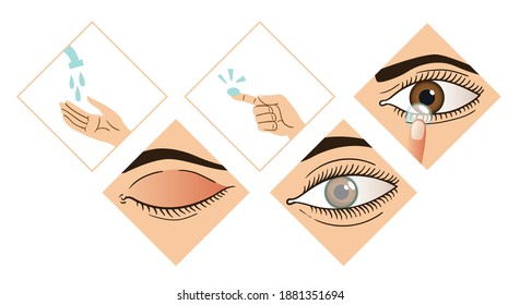 Contact lens infographic. Instruction how to put on lenses. 5 steps wash your hands, take a lens, check the position of the lens. Carefully insert the lens. Design of the brochure