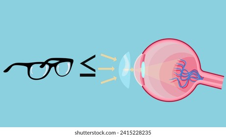 Contact lens vs glasses, color flat illustration