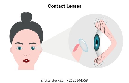 Lentes de contato com caso Oftalmologia oculista 