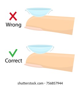 Contact lenses - correct and wrong position, cartoon illustration of medical devices for correct vision. Vector