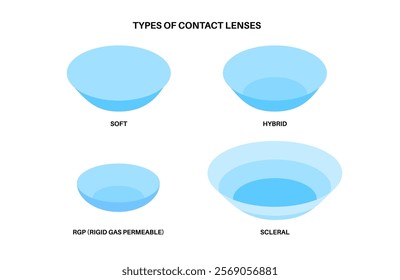 Contact lenses poster, ocular prosthesis, rigid gas permeable, soft or scleral types. Vision problem concept, cosmetic effect or treatment. Refraction error correction flat vector medical illustration