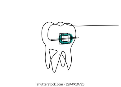 Continuous line art of Orthodontic treatment. Dentists day and respect for their services to humanity. Dental procedures vector art concept. Isolated vector of teeth and jaws. Retainers braces denture